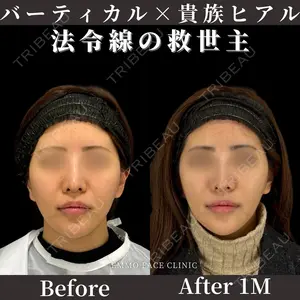 EMMO FACE CLINIC 東京三田院 木之下 哲彦医師の症例