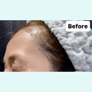 REVI CLINIC銀座院 の症例