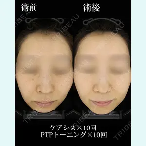 HAAB×DREAM BEAUTY CLINIC 大阪梅田院の症例