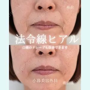 小暮整形外科・美容外科の症例