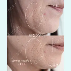 小暮整形外科・美容外科の症例