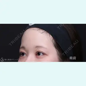 聖心美容クリニック 銀座院 川端 優也医師の症例