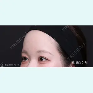 聖心美容クリニック 銀座院 川端 優也医師の症例