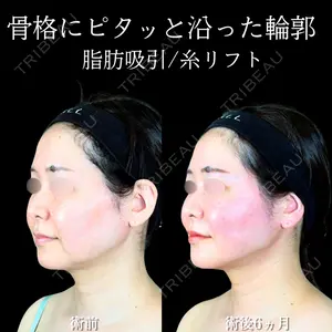 アリエル美容クリニック 大宮院 江郷隼一郎医師の症例