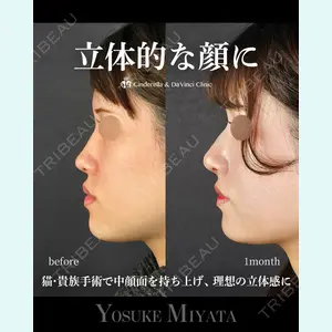 シンデレラ＆ダヴィンチクリニック 宮田 洋佑医師の症例