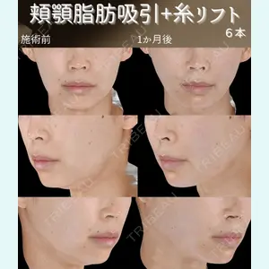 下北沢スキンクリニックの症例