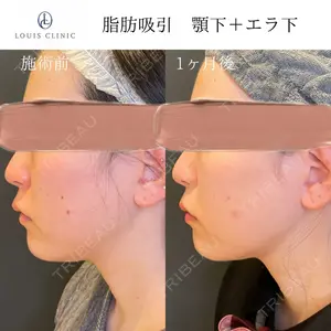 LOUIS CLINIC 二子玉川院【ルイクリニック】 小松 塁医師の症例