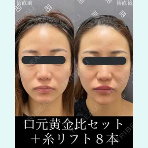 EMMO FACE CLINIC 大宮院 廣松 直樹医師の症例