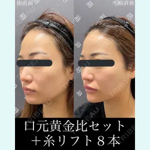 EMMO FACE CLINIC 大宮院 廣松 直樹医師の症例