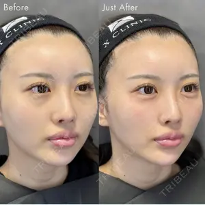 X CLINIC 銀座院 王　浚昊医師の症例