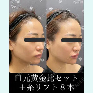 EMMO FACE CLINIC 大宮院 廣松 直樹医師の症例