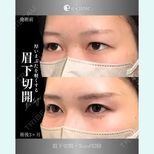 eクリニック 大阪院 八木 良太医師の症例