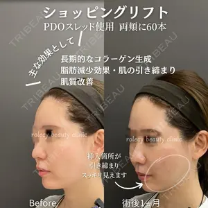 ロレシー美容クリニック 心斎橋駅前院 福留院長医師の症例