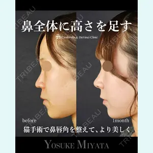 シンデレラ＆ダヴィンチクリニック 宮田 洋佑医師の症例