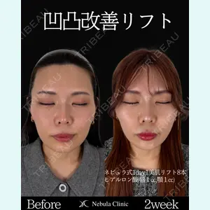 ネビュラクリニック 東京錦糸町院 岩切 琢磨医師の症例