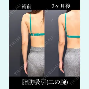 HAAB×DREAM BEAUTY CLINIC 東京本院 吉岡 修一医師の症例