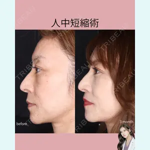 吉祥寺アイビークリニック 巴 窓花医師の症例