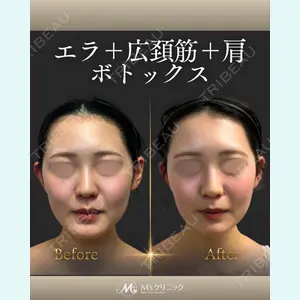 M'sクリニック【エムズクリニック】の症例