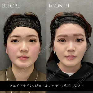 RIVER CLINIC（リバークリニック）の症例