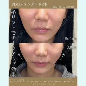 Ginza 78 Clinic 安田百合子医師の症例