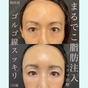 EMMO FACE CLINIC 大宮院 廣松 直樹医師の症例