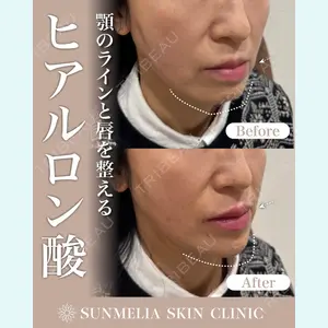 SUNMELIA SKIN CLINICの症例