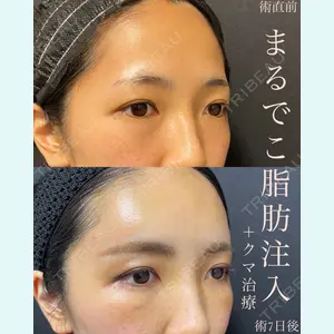 EMMO FACE CLINIC 大宮院 廣松 直樹医師の症例