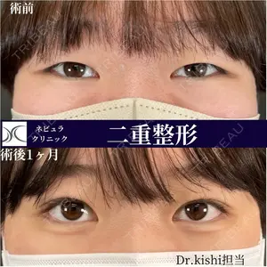 ネビュラクリニック 京都院 岸 大輔医師の症例