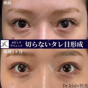 ネビュラクリニック 京都院 岸 大輔医師の症例