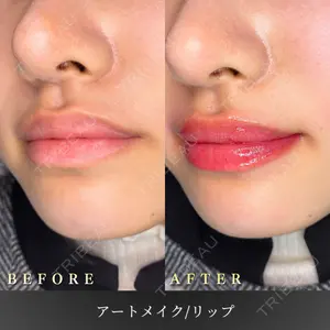 BiBiクリニックの症例