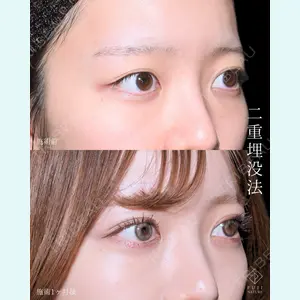 藤・ナチュレ美容クリニック 銀座院 小川 杏平医師の症例