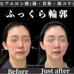 EMMO FACE CLINIC 東京三田院 木之下 哲彦医師の症例