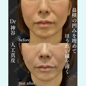 EMMO FACE CLINIC 大阪梅田院 神谷 一成医師の症例