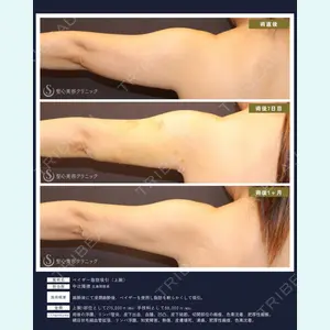 聖心美容クリニック 広島院 中辻 隆徳医師の症例