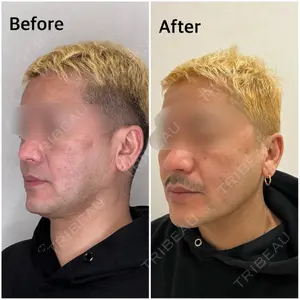 GRACY TOKYO CLINIC【グレイシートウキョウクリニック】 江本 正樹医師の症例