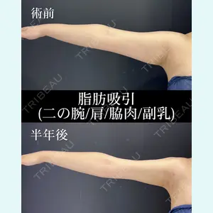 HAAB×DREAM BEAUTY CLINIC 大阪梅田院 柏木 太雅医師の症例