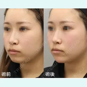 銀座みゆき通り美容外科 大阪梅田院 北澤真歩医師の症例