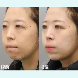 銀座みゆき通り美容外科 大阪梅田院 岩井謙治医師の症例