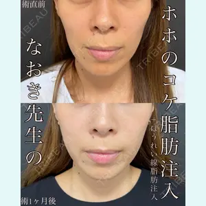 EMMO FACE CLINIC 大宮院 廣松 直樹医師の症例