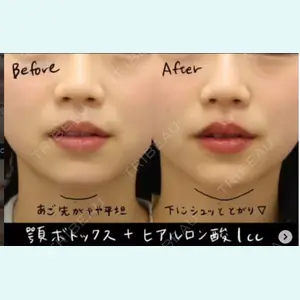 銀座みゆき通り美容外科 大阪梅田院 北澤真歩医師の症例