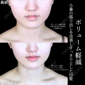 アリエル美容クリニック 大宮院 阪野 一世医師の症例