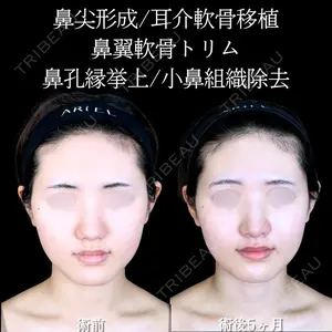 アリエル美容クリニック 大宮院 阪野 一世医師の症例