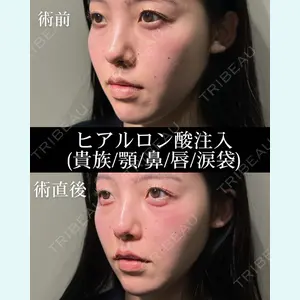 HAAB×DREAM BEAUTY CLINIC 大阪梅田院 錦 実奈医師の症例