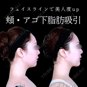 アリエル美容クリニック 水戸院 天白 典秀医師の症例