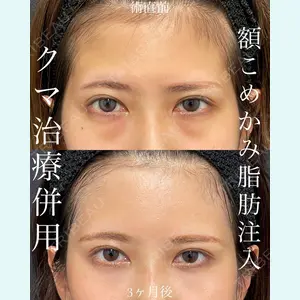 EMMO FACE CLINIC 大宮院 廣松 直樹医師の症例