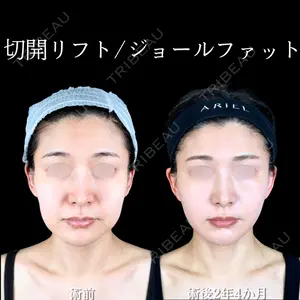 アリエル美容クリニック 大宮院 阪野 一世医師の症例