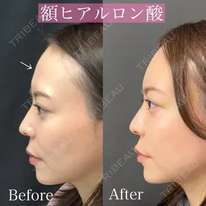 ルラ美容クリニック 渋谷本院 昼間 路子医師の症例