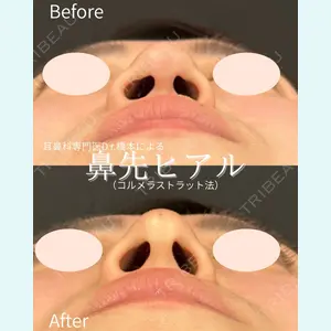 ルラ美容クリニック 仙台院 / ルラスキンクリニック 仙台院 橋本 英樹医師の症例