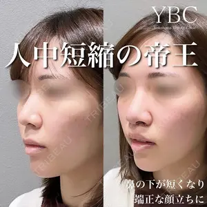 YBC横浜美容外科 大宮院 磯村 亮輔医師の症例