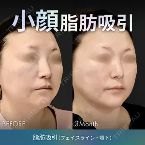 ジョウクリニック 高知院 溝渕　貴俊医師の症例